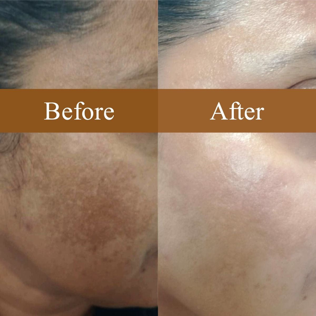 celimax Pore+Dark Spot Brightening Cream 35ml