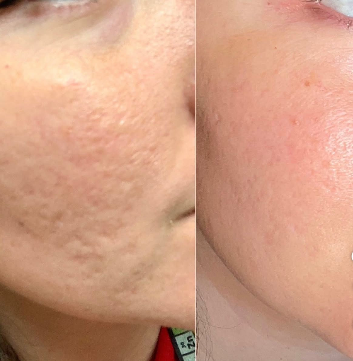 celimax Pore+Dark Spot Brightening Cream 35ml
