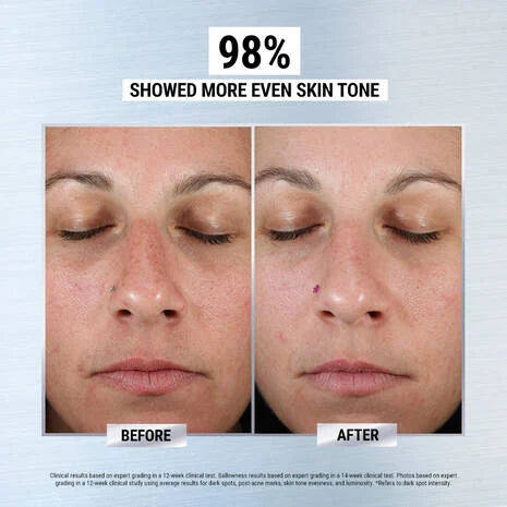 KIEHL'S Clearly Corrective Dark Spot Corrector