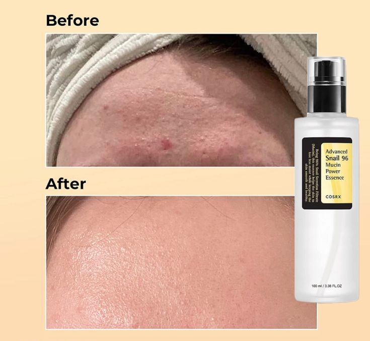 COSRX advanced snail 96 mucin power essence 100ml