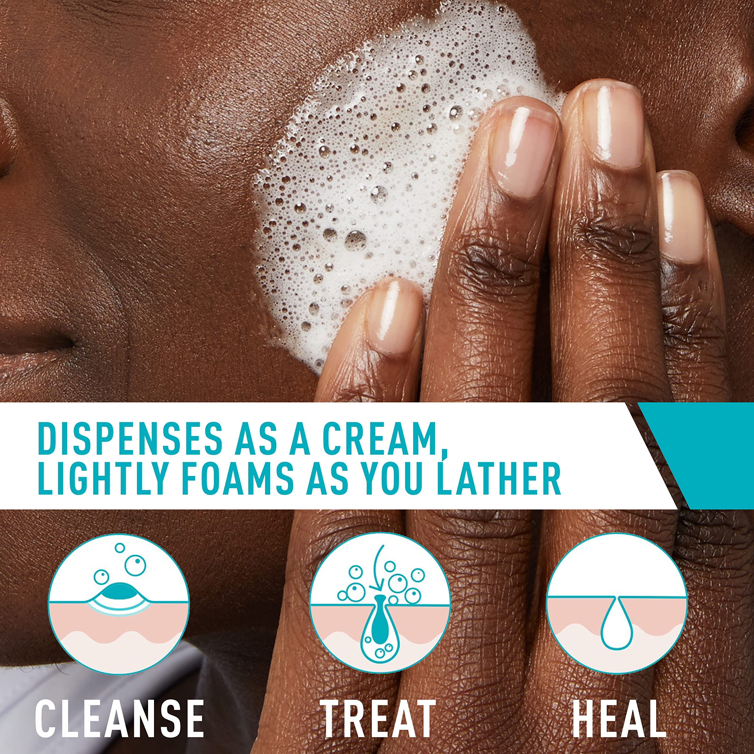 CERA VE Acne Foaming Cream Cleanser
