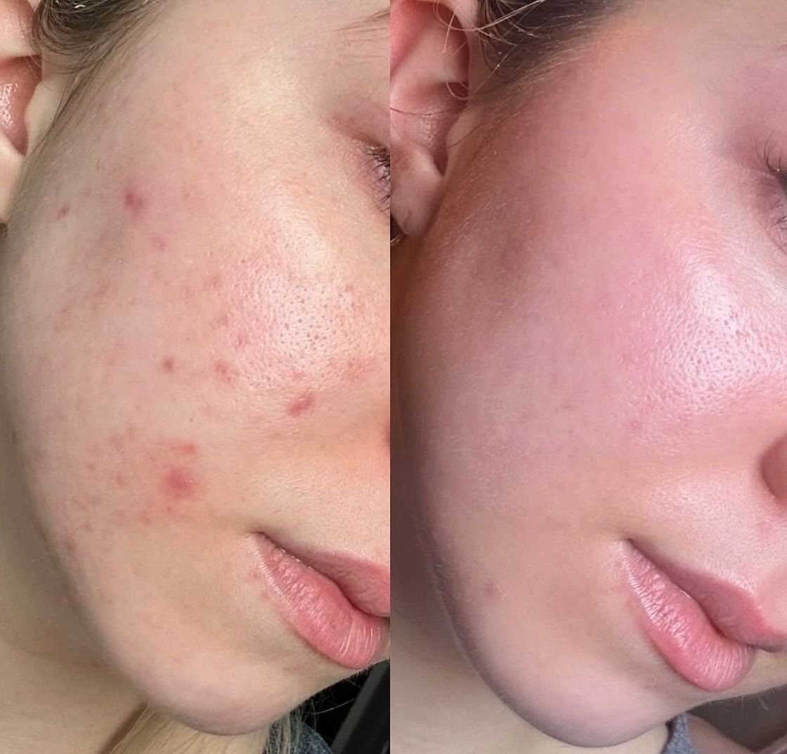 celimax Pore+Dark Spot Brightening Cream 35ml