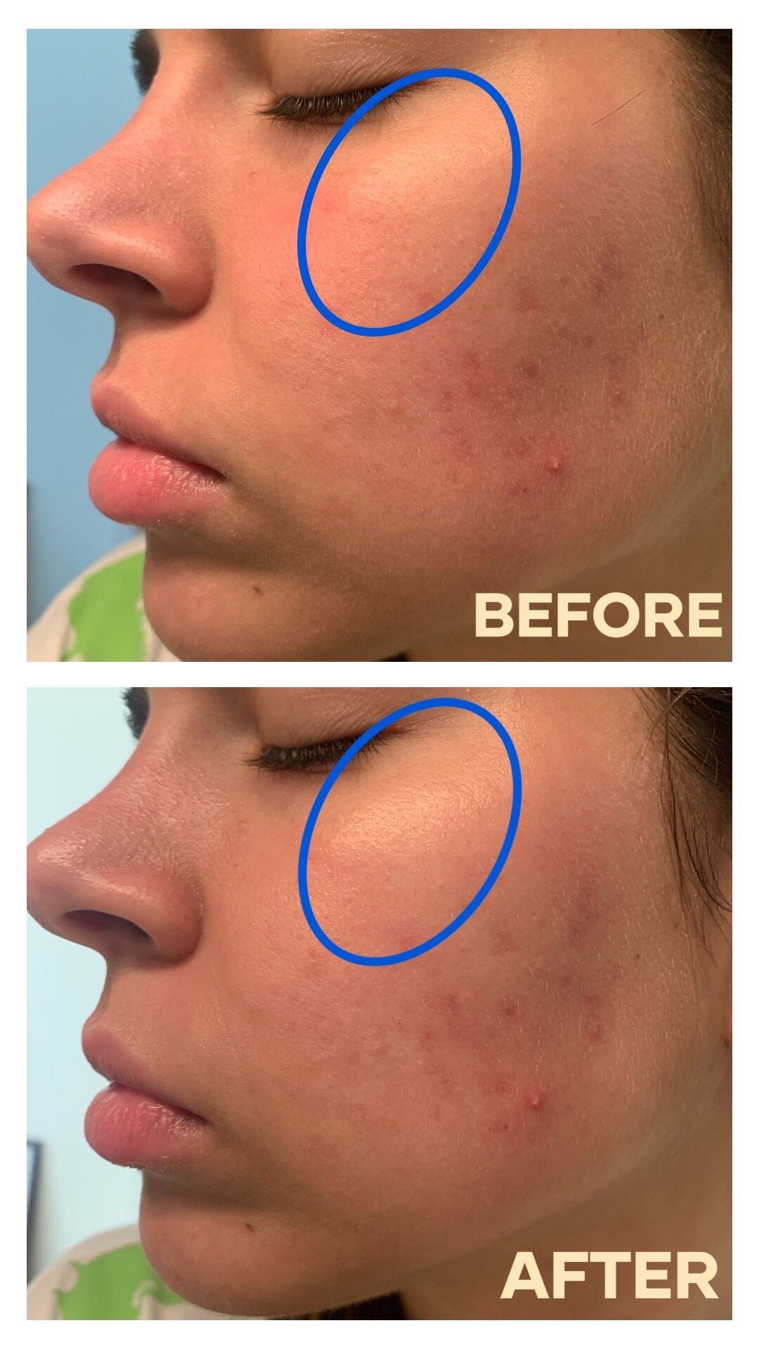 ESTEE LAUDER Advanced Night Repair Synchronized Multi Recovery Complex