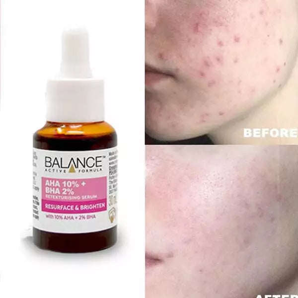Balance Active Formula | AHA 10% + BHA 2% Serum
