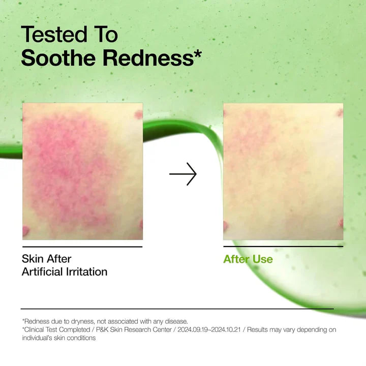 Anua Azelaic Acid 10 Hyaluron Redness Soothing Serum – 30ml | korea